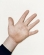 Fig.14 Leonid Stadnyk's Hand, Podoliantsy, Ukraine